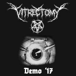 Vitrectomy : Demo '17